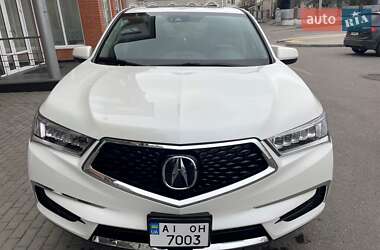 Acura MDX  2017