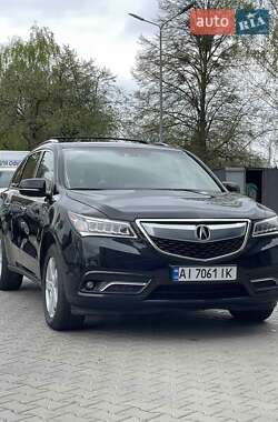 Acura MDX  2014