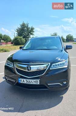 Acura MDX  2014