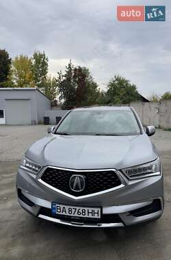 Acura MDX  2017
