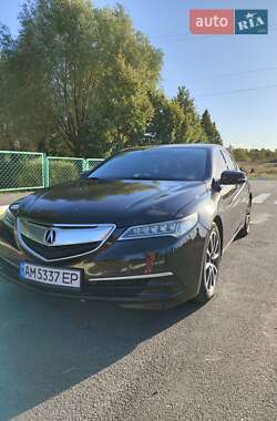 Acura TLX 2015