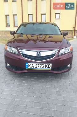 Ціни Acura ILX Бензин