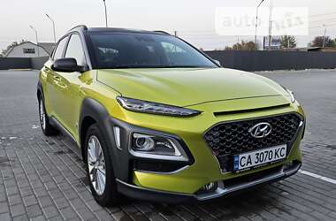 Ціни Hyundai Kona Бензин