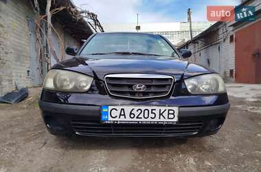 Ціни Hyundai Elantra Газ пропан-бутан / Бензин