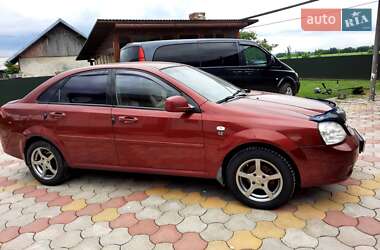 Ціни Chevrolet Lacetti Газ пропан-бутан / Бензин