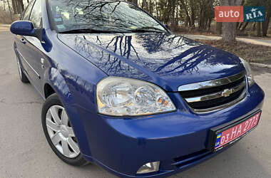 Ціни Chevrolet Nubira Газ пропан-бутан / Бензин