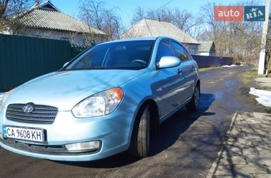 Ціни Hyundai Седан в Смілі
