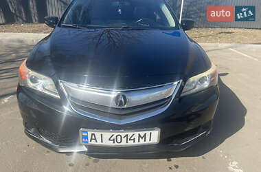 Ціни Acura ILX Седан