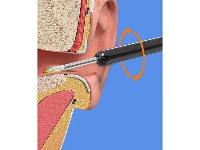Беспроводной прибор для чистки ушей NE3 отоскоп - Фото 9