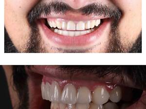 Безкоштовно консультація лікаря стоматолога