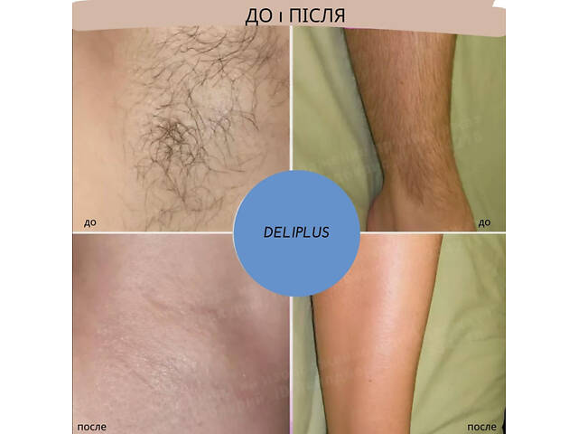 Чоловічий крем для депіляції Deliplus для всіх типів шкіри 2 в 1 (крем + рукавиця) 200 мл. Deliplus Men Crema Depil 2 - Фото 5