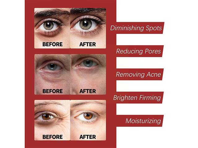 Крем для обличчя OUHOE Retinol 30г. Крем від зморшок OUHOE Retinol. Поживний крем для освітлення та зволоження - Фото 7