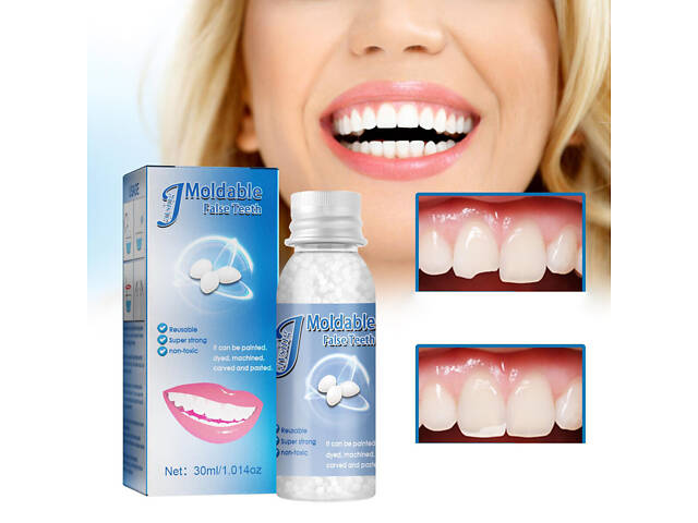 М’який пластик для тимчасового протезування зубів 30 мл — термопластик полікапролактон (ПКЛ) для моделювання, ліплення - Фото 1
