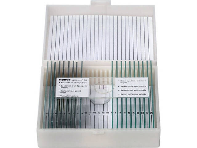 Набор микропрепаратов Konus Патологічні тканини людського тіла, частина I 10 шт (4914) - Фото 1