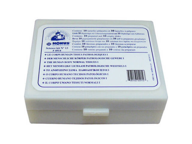 Набор микропрепаратов Konus Патологічні тканини людського тіла, частина I 10 шт (4914) - Фото 4