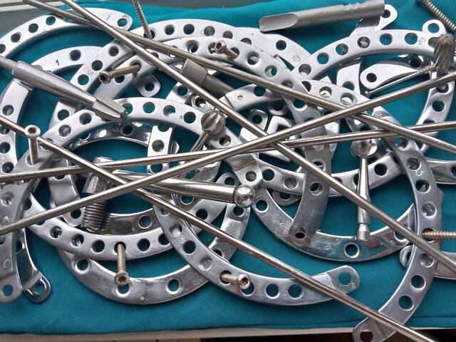 Ортопедія травматологія гвинти, кільця, стрижні. - Фото 1