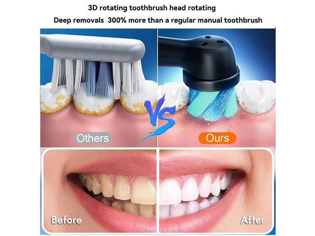 Електрична зубна щітка з 4 змінними насадками, USB-перезаряджання, таймер. Рожева - Фото 6