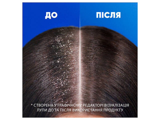 Шампунь Head & Shoulders Основний догляд 250 мл (8006540063330) - Фото 5