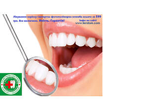 Стоматология Киев Пломба фотополимерная 599 грн. Все включено.