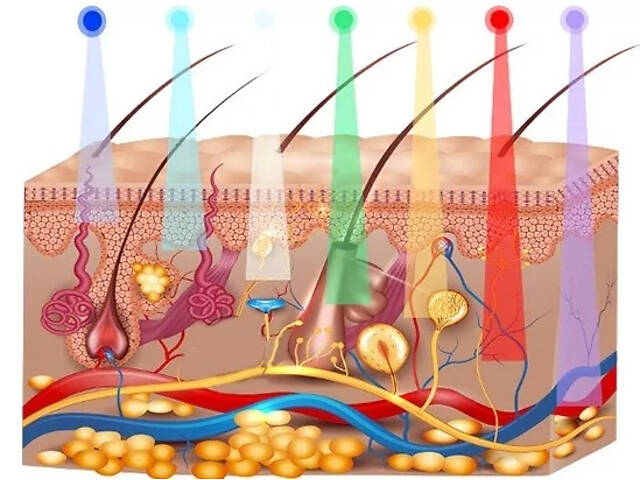 Светодиодная лампа-дуга SD-075 для фотодинамической терапии с паром (6 цветов) - Фото 7