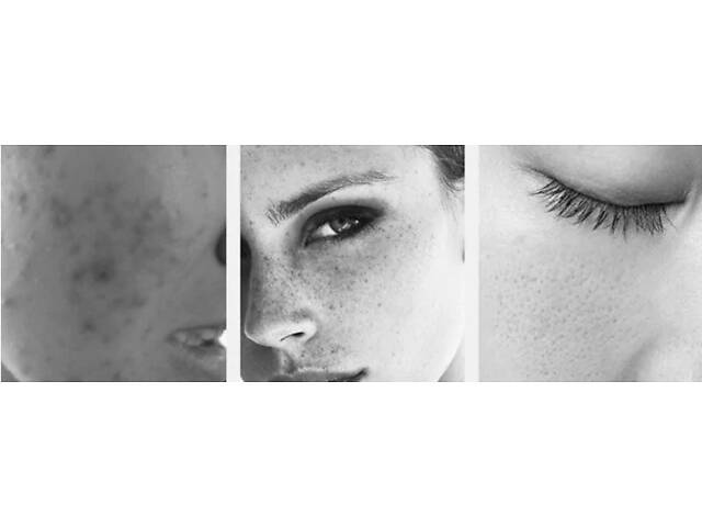 Светодиодная лампа-дуга SD-075 для фотодинамической терапии с паром (6 цветов) - Фото 9