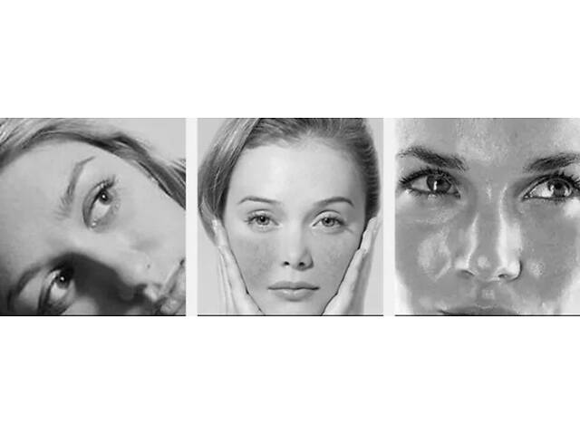 Светодиодная лампа-дуга SD-075 для фотодинамической терапии с паром (6 цветов) - Фото 10