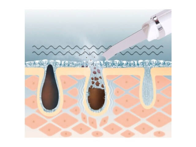 Ультразвуковой скрабер для чистки лица Maierda A-188 - Фото 2