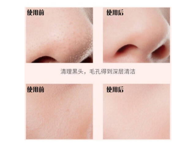 Ультразвуковой скрабер для чистки лица Maierda A-188 - Фото 4