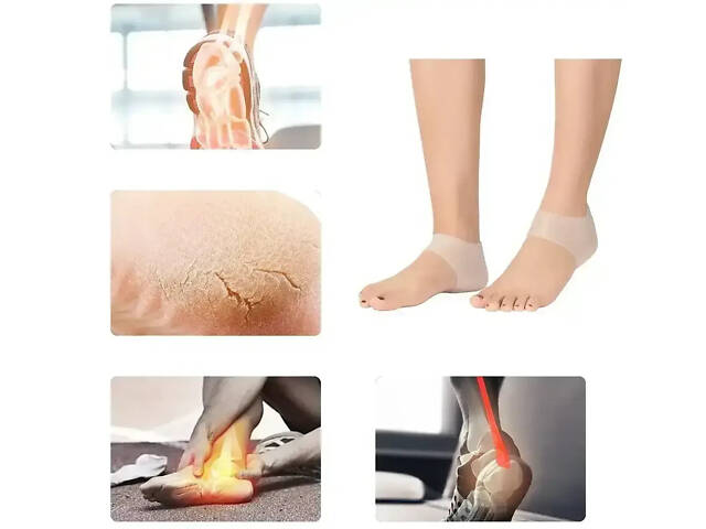 УЦЕНКА! Силиконовые протекторы для пяток (Нет упаковки 3008) - Фото 1