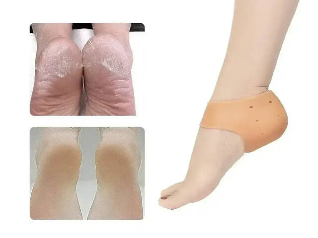 УЦЕНКА! Силиконовые протекторы для пяток (Нет упаковки 3008) - Фото 6