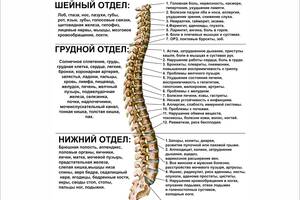 Плакат Нарушения в работе позвоночника А0