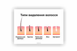 Плакат Типы удаления волос Vivay 84х118 см Белый