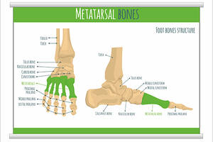 Плакат Vivay Metatarsal bones с планкой А0 (9015)