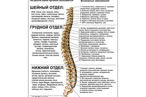 Плакат Vivay Нарушения в работе позвоночника А0 (4693)