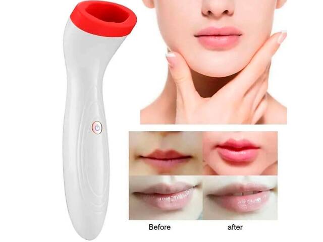 Устройство для увеличения губ (плампер) XPRo Beautiful lips (TV000123_273)