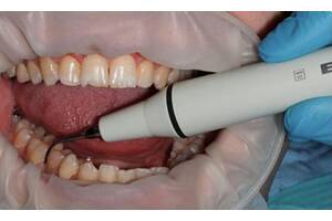 Проф гигиена полости рта у стоматолога