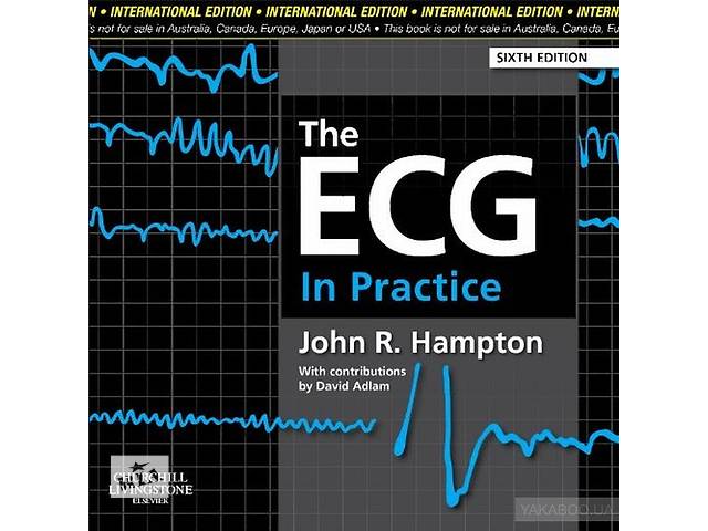 The ECG in Practice